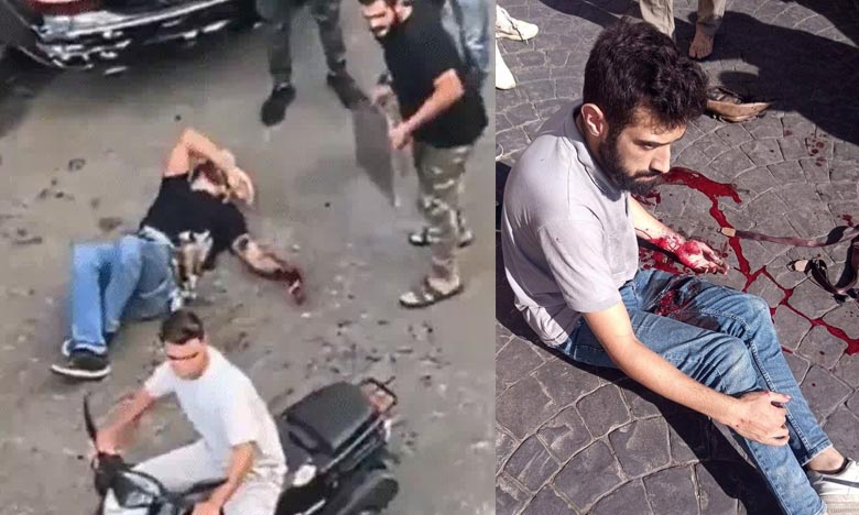 Serial blasts in pagers of Hezbollah members in Lebanon: 8 killed, over 2700 injured, including Iranian ambassador; Israeli hacking claimed